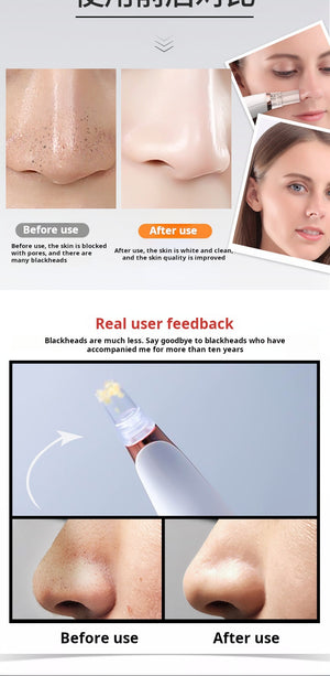 New electric blackout removal pore cleansing acne oil removal face home beauty device black head device