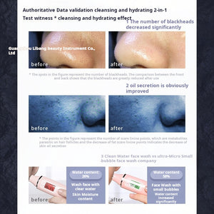 Hydro-Pore Cleanser with Oxygen Infusion  Home Blackhead Suction Device (3 Variants)