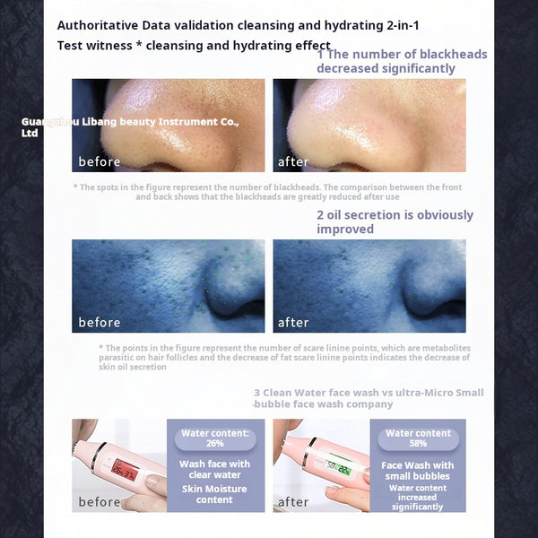 Hydro-Pore Cleanser with Oxygen Infusion  Home Blackhead Suction Device (3 Variants)